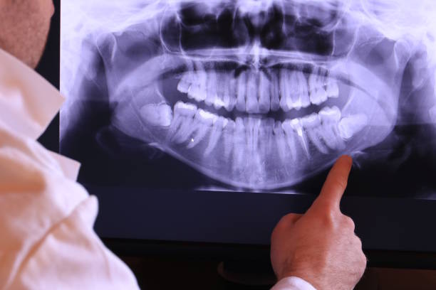 Dentist for Dental Trauma in IN