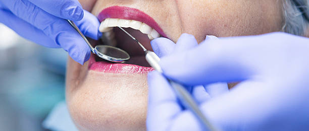 Best Broken Tooth Emergency  in Fort Branch, IN